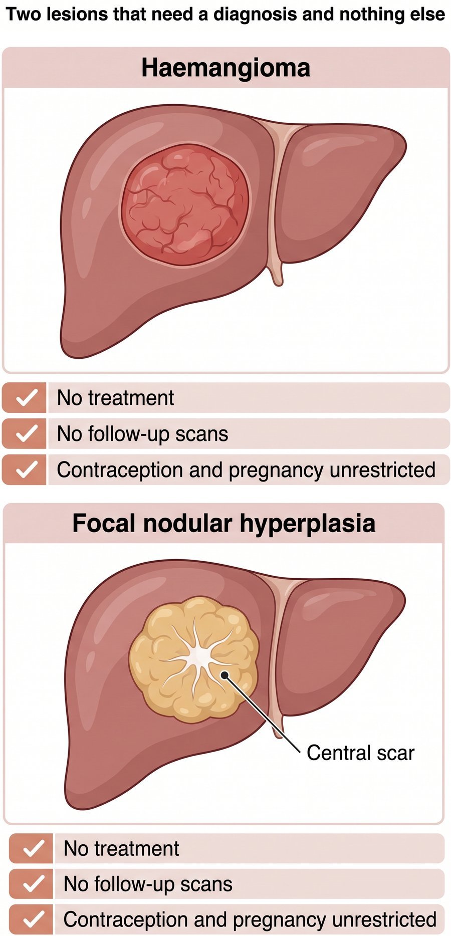 Haemangioma and focal nodular hyperplasia in the liver, two lesions that need a diagnosis but no treatment or follow-up scans.