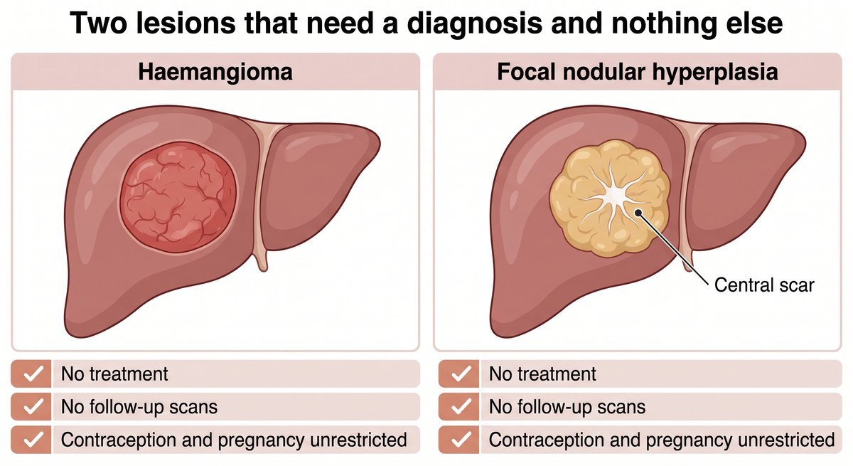 Haemangioma and focal nodular hyperplasia in the liver, two lesions that need a diagnosis but no treatment or follow-up scans.