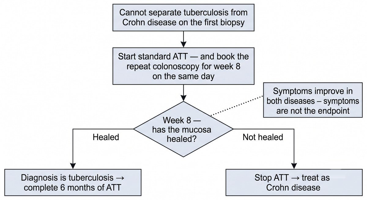 Flowchart: when tuberculosis cannot be separated from Crohn disease, ATT is started and a repeat colonoscopy is booked for week 8; healed mucosa means tuberculosis and the full course continues, unhealed mucosa means ATT is stopped and Crohn disease is treated.